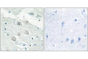 Immunohistochemistry analysis of paraffin-embedded human brain tissue, using JAK1 Antibody. (JAK1 Antikörper  (AA 91-140))