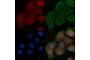 ABIN6259325 and ABIN6275280 staining Hela cells by IF/ICC.