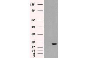 HEK293T cells were transfected with the pCMV6-ENTRY control (Left lane) or pCMV6-ENTRY AK1 (Right lane) cDNA for 48 hrs and lysed. (Adenylate Kinase 1 Antikörper)