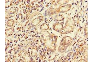 Immunohistochemistry (IHC) image for anti-Fc Fragment of IgG, Low Affinity IIa, Receptor (CD32) (FCGR2A) (AA 241-317) antibody (ABIN7158537)