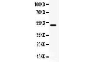 Anti- CD80 antibody, Western blottingAll lanes: Anti CD80  at 0. (CD80 Antikörper  (C-Term))