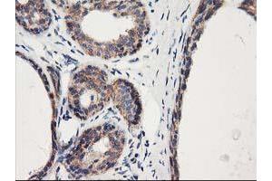 Immunohistochemical staining of paraffin-embedded Human breast tissue using anti-HARS2 mouse monoclonal antibody. (HARS2 Antikörper)