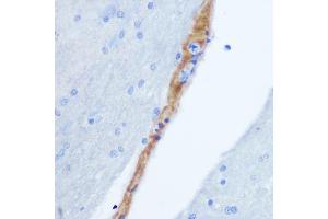 Immunohistochemistry (IHC) image for anti-Gastrin-Releasing Peptide (GRP) (AA 1-148) antibody (ABIN6141433)