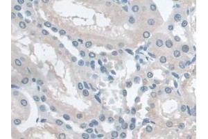 DAB staining on IHC-P; Samples: Rat Kidney Tissue (Butyrylcholinesterase Antikörper  (AA 345-570))