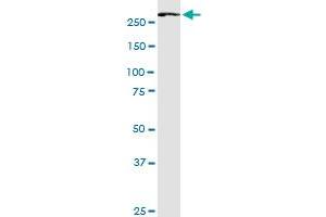 FASN monoclonal antibody (M02), clone 3B3-1D6. (Fatty Acid Synthase Antikörper  (AA 1-439))