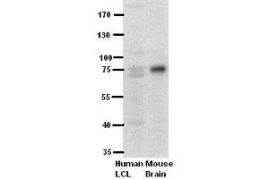 WB Suggested Anti-PFKL Antibody Titration:  5% Milk  ELISA Titer:  dilution: 1:500  Positive Control:  human LCL and mouse brains