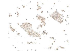 Immunocytochemistry (ICC) image for anti-AT Rich Interactive Domain 2 (ARID, RFX-Like) (ARID2) (AA 1785-1835) antibody (ABIN7449532) (Rekombinanter ARID2 Antikörper  (AA 1785-1835))