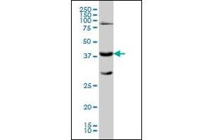 Western Blotting (WB) image for anti-Galactose-1-Phosphate Uridylyltransferase (GALT) antibody (ABIN781864) (GALT Antikörper)