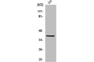 Western Blot analysis of 293 cells using MAGE-C2 Polyclonal Antibody (MAGEC2 Antikörper  (Internal Region))