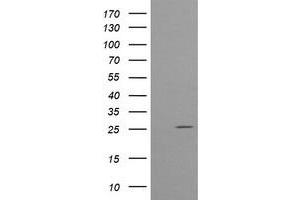 Image no. 6 for anti-Cytidine Monophosphate (UMP-CMP) Kinase 1, Cytosolic (CMPK1) antibody (ABIN1497544)
