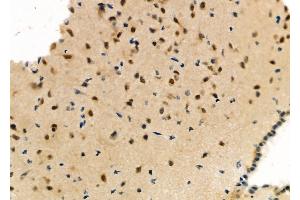 ABIN6263478 and ABIN6273142 at 1/100 staining Mouse brain tissue by IHC-P. (Myosin XVIIIA Antikörper  (Internal Region))