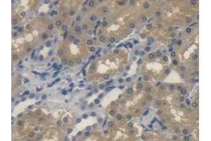 IHC-P analysis of Rat Kidney Tissue, with DAB staining. (Sonic Hedgehog Antikörper  (AA 237-399))