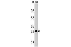Western blot analysis of PSMA5 polyclonal antibody  in HL-60 cell line lysates (35 ug/lane). (PSMA5 Antikörper  (Internal Region))