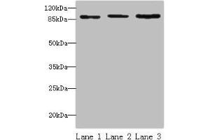 Western blot All lanes: STAT5B antibody at 16 μg/mL Lane 1: HepG2 whole cell lysate Lane 2: K562 whole cell lysate Lane 3: Hela whole cell lysate Secondary Goat polyclonal to rabbit IgG at 1/10000 dilution Predicted band size: 90 kDa Observed band size: 90 kDa (STAT5B Antikörper  (AA 40-280))