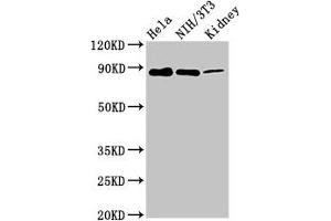 Western Blot Positive WB detected in: Hela whole cell lysate, NIH/3T3 whole cell lysate, Rat kidney tissue All lanes: PTPN12 antibody at 7. (PTPN12 Antikörper  (AA 539-714))