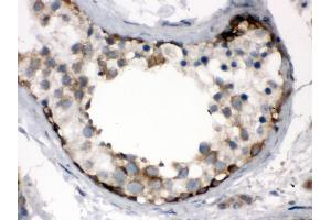 Immunohistochemistry (Paraffin-embedded Sections) (IHC (p)) image for anti-T-Complex 1 (TCP1) (AA 515-551), (C-Term) antibody (ABIN3043417)
