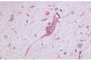 Anti-LPHN1 antibody  ABIN1049022 IHC staining of human brain, neurons and glia. (Latrophilin 1 Antikörper  (N-Term))