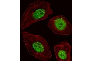 Fluorescent image of A549 cell stained with BLZF1 Antibody (Center) (ABIN653552 and ABIN2842935). (BLZF1 Antikörper  (AA 156-184))