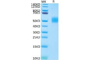 MICB Protein (AA 23-298) (His-Avi Tag)