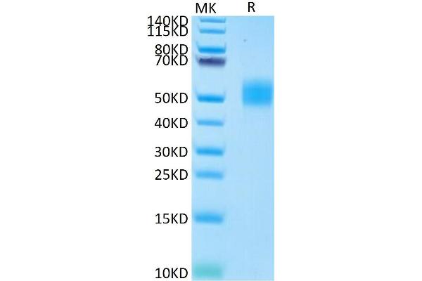 MICB Protein (AA 23-298) (His-Avi Tag)
