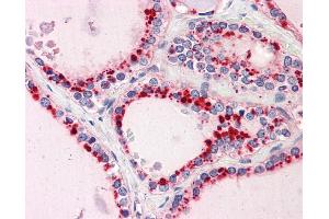 IHC Information: Paraffin embedded thyroid tissue, tested with an antibody dilution of 5 ug/ml. (RYBP Antikörper  (N-Term))