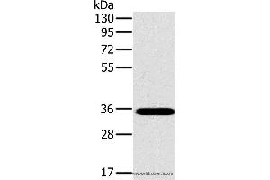 Western blot analysis of Mouse brain tissue, using OTUB1 Polyclonal Antibody at dilution of 1:800 (OTUB1 Antikörper)