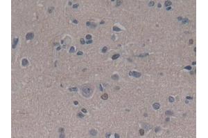 Detection of ABCC8 in Human Cerebrum Tissue using Polyclonal Antibody to ATP Binding Cassette Transporter C8 (ABCC8) (ABCC8 Antikörper  (AA 679-929))