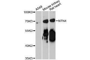 Western blot analysis of extracts of various cell lines, using NTN4 antibody (ABIN6290686) at 1:3000 dilution. (Netrin 4 Antikörper)