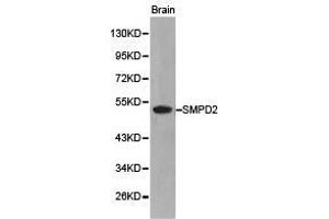 Western Blotting (WB) image for anti-Sphingomyelin phosphodiesterase 2, Neutral Membrane (Neutral Sphingomyelinase) (SMPD2) antibody (ABIN1874877) (SMPD2 Antikörper)
