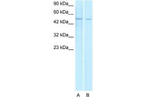 WB Suggested Anti-ERG Antibody Titration:  1. (ERG Antikörper  (Middle Region))