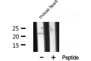 Western blot analysis of CLDN7 expression in Mouse Heart lysate (Claudin 7 Antikörper  (C-Term))