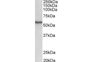 Western Blotting (WB) image for anti-serine/threonine Kinase 38 (STK38) (AA 420-431) antibody (ABIN1104516) (STK38 Antikörper  (AA 420-431))