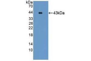 Detection of Recombinant GRPR, Mouse using Polyclonal Antibody to Gastrin Releasing Peptide Receptor (GRPR) (GRPR Antikörper)