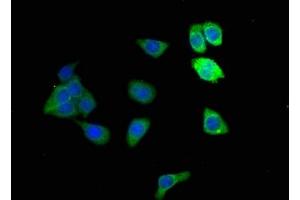 Immunofluorescence staining of HepG2 cells with ABIN7143645 at 1:166, counter-stained with DAPI. (ADH1B Antikörper  (AA 2-375))