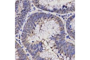 Immunohistochemistry (Paraffin-embedded Sections) (IHC (p)) image for anti-Natriuretic Peptide A (NPPA) (AA 26-151) antibody (ABIN3022234)