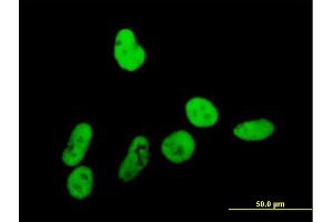 Immunofluorescence of purified MaxPab antibody to GTF2I on HeLa cell.