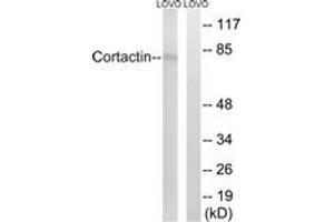 Western Blotting (WB) image for anti-Cortactin (CTTN) (AA 441-490) antibody (ABIN2888968) (Cortactin Antikörper  (AA 441-490))