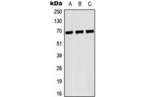 Western blot analysis of CD42b expression in Hela (A), NIH3T3 (B), H9C2 (C) whole cell lysates. (CD42b Antikörper  (Center))