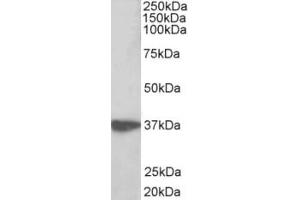 Western Blotting (WB) image for anti-Aminoacyl tRNA Synthetase Complex-Interacting Multifunctional Protein 1 (AIMP1) (AA 593-606) antibody (ABIN2465096) (AIMP1 Antikörper  (AA 593-606))