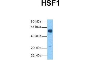 Host:  Rabbit  Target Name:  HSF1  Sample Tissue:  Human Fetal Brain  Antibody Dilution:  1. (HSF1 Antikörper  (C-Term))