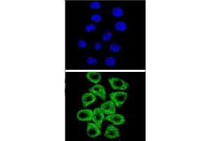 Confocal immunofluorescent analysis of CITED2 Antibody (C-term) (ABIN654133 and ABIN2844005) with Hela cell followed by Alexa Fluor® 489-conjugated goat anti-rabbit lgG (green). (CITED2 Antikörper  (C-Term))