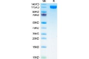 Mouse P-Selectin/CD62P on Tris-Bis PAGE under reduced condition. (P-Selectin Protein (AA 42-709) (His tag))