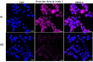 Immunocytochemical staining of HeLa cells using Phospho-beta Arrestin 1 (S412) antibody (ABIN7797654), 1:1,000), Top panel: wild-type (WT), Bottom panal: Phospho-beta Arrestin 1 (S412) shRNA knockdown (KD). (Rekombinanter beta Arrestin 1 Antikörper  (pSer412))