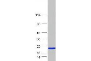 Western Blotting (WB) image for DCMP Deaminase (DCTD) (Transcript Variant 2) protein (Myc-DYKDDDDK Tag) (ABIN2719251)