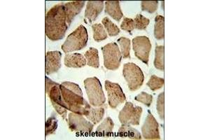 Formalin-fixed and paraffin-embedded human skeletal muscle reacted with Denatured ATG1 Antibody, which was peroxidase-conjugated to the secondary antibody, followed by DAB staining. (Denatured ATG1 Antikörper)