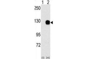 Western Blotting (WB) image for anti-TYRO3 Protein Tyrosine Kinase (TYRO3) antibody (ABIN3003422) (TYRO3 Antikörper)