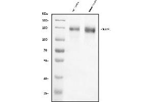 Western blot analysis of DLGAP1 using anti-DLGAP1 antibody (ABIN7600257).