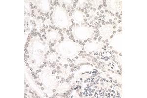 Immunohistochemistry (IHC) image for anti-AT Rich Interactive Domain 1B (SWI1-Like) (ARID1B) (AA 1850-1900) antibody (ABIN7448416)