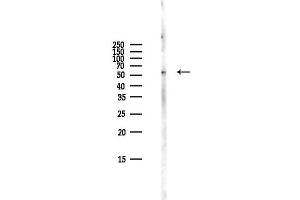 anti-Protein Kinase C Substrate 80K-H (PRKCSH) (Internal Region) antibody