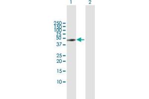 Western Blot analysis of GART expression in transfected 293T cell line by GART MaxPab polyclonal antibody. (GART Antikörper  (AA 1-433))